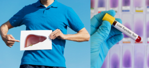 At-home Liver Test Versus Going to the Doctor for Testing