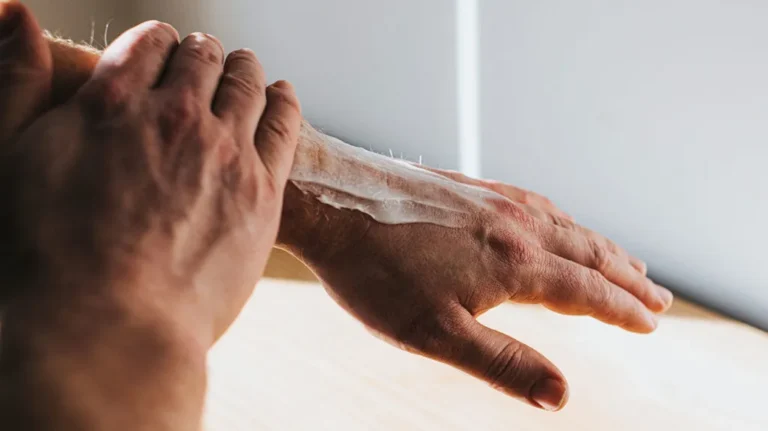 Hydroquinone Cream: Uses, Benefits, and Risks