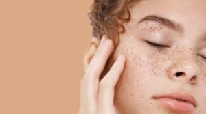 Skin Pigmentation Types, Causes and Treatment—A Review