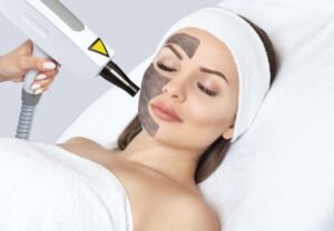 What is Hollywood Laser Peeling