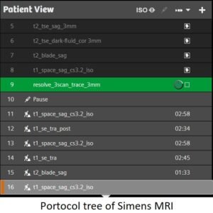 The Imperative of Selecting Optimal MRI Protocols for Optic Nerve Glioma Imaging
