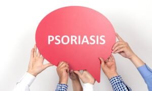 The Relationship Between Diet and Psoriasis: Debunking Myths