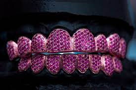 A Shining Smile: Unveiling the Art of Custom Grillz