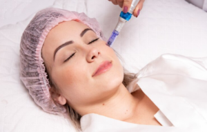 Professional Microneedling Pen- How does it work, and what skin issues can it treat?