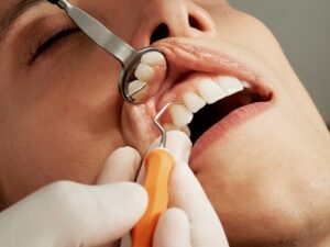 Beyond the Surface: The Fusion of Beauty and Dentistry with BOTOX and Dermal Fillers