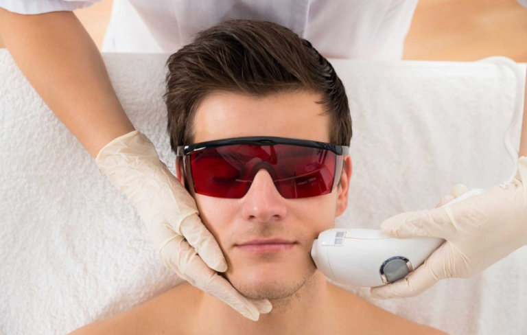 Laser Hair Removal for Facial Hair: A Comprehensive Guide