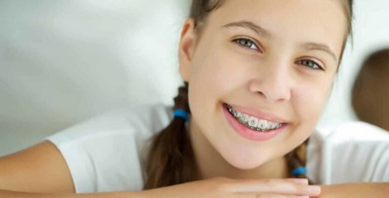 Why Braces and Orthodontics in Minnesota Will Change Your Life