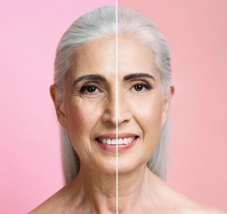 Age Gracefully: How Anti-Wrinkle Treatments Work