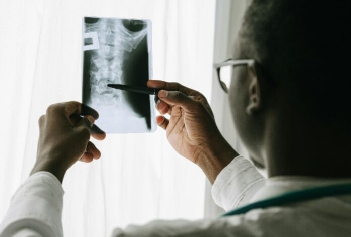 What to do to prepare for getting an X-ray