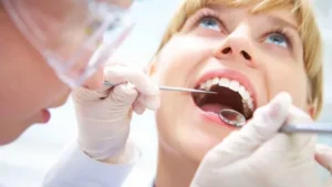 How Often Should You Replace Your Dental Fillings?