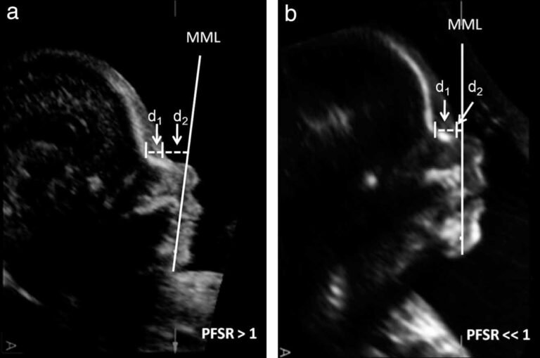 Pathfinder System Reference Document (PFSRD20): A Comprehensive Guide