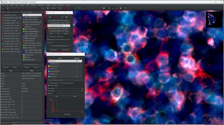 Understanding Pixel Length in QuPath: A Comprehensive Guide